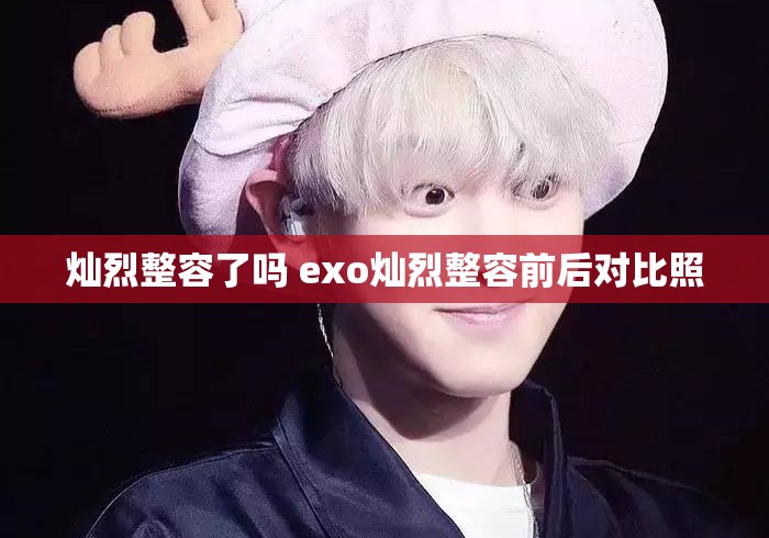 灿烈整容了吗 exo灿烈整容前后对比照